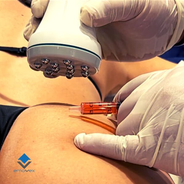 MesoVex Mesoterapia Virtual